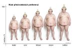 preferekce
